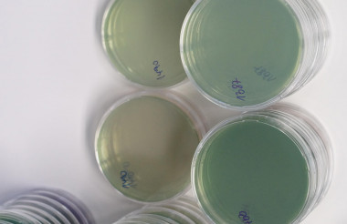 Laboruntersuchung Legionellenprüfung